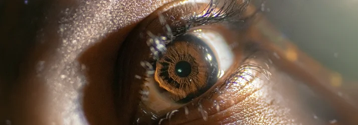 FC – Personalized Myopia Treatment at Eyes Now in Dallas-Fort Worth Area TX